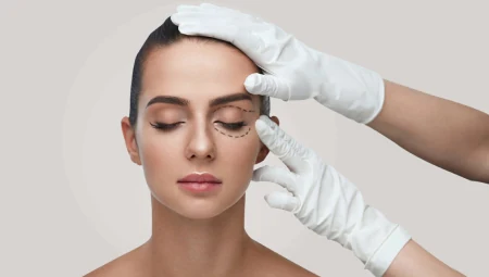 Tạo hình Thẩm mỹ Mắt