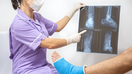 Nẹp Cố Định & Bó Bột Gãy Xương
