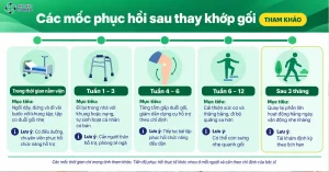 Sau Thay Khớp Gối Bao Lâu Thì Đi Được? Các Mốc Phục Hồi & Bài Tập Chuẩn Y Khoa