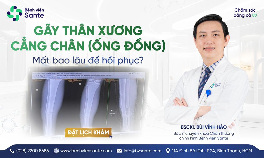 GÃY XƯƠNG CẲNG CHÂN (ỐNG ĐỒNG) MẤT BAO LÂU ĐỂ HỒI PHỤC?