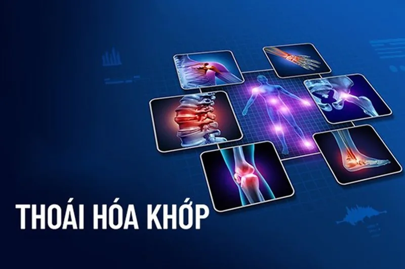 Bệnh viện Sante - Thoái hóa khớp