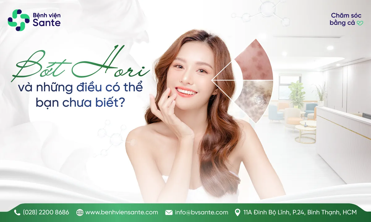 BỚT HORI VÀ NHỮNG ĐIỀU CÓ THỂ BẠN CHƯA BIẾT? - Bệnh viện SANTE Bình Thạnh, TP.HCM