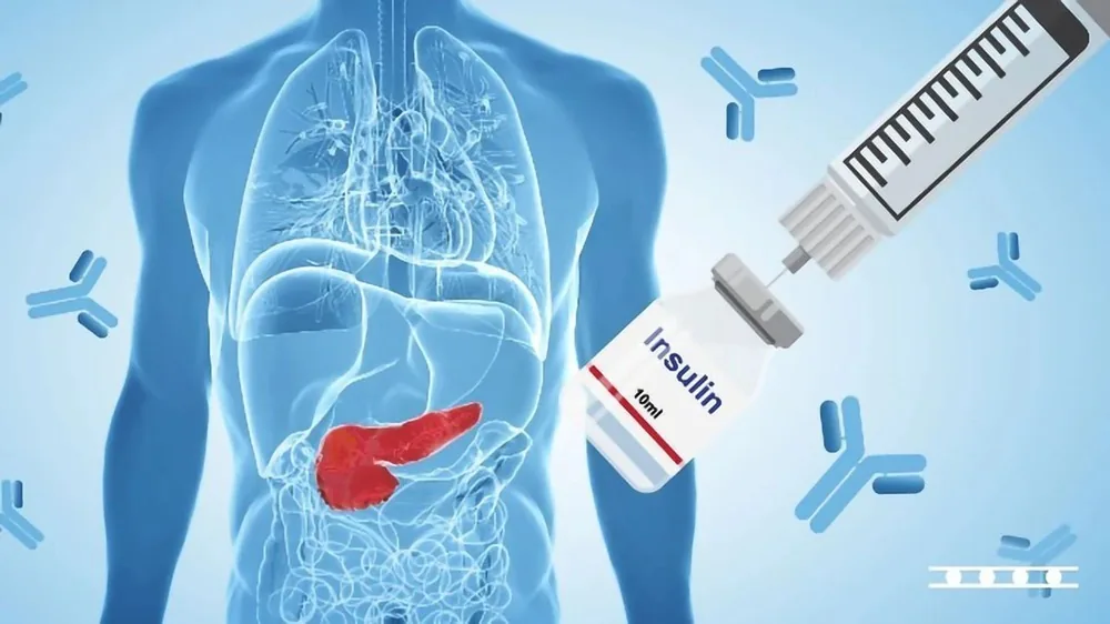 Đái tháo đường tác nhân "Thầm lặng" gây ra bệnh thận mạn - Hình 3 - Bệnh viện SANTE Bình Thạnh, TP.HCM Đái tháo đường tác nhân "Thầm lặng" gây ra bệnh thận mạn - Hình 3 - Bệnh viện SANTE Bình Thạnh, TP.HCM