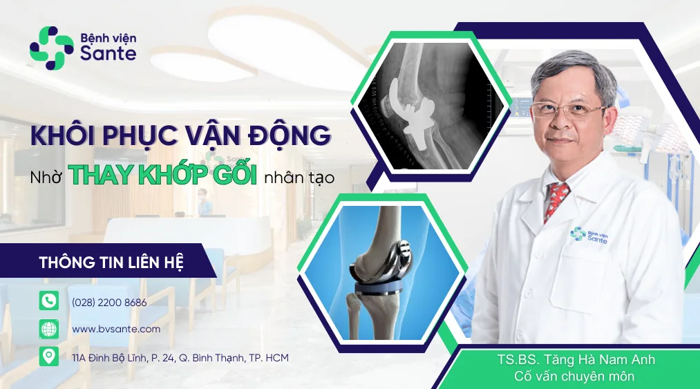 Khôi phục vận động nhờ thay khớp gối nhân tạo - Bệnh viện SANTE Bình Thạnh, TP.HCM Khôi phục vận động nhờ thay khớp gối nhân tạo - Bệnh viện SANTE Bình Thạnh, TP.HCM