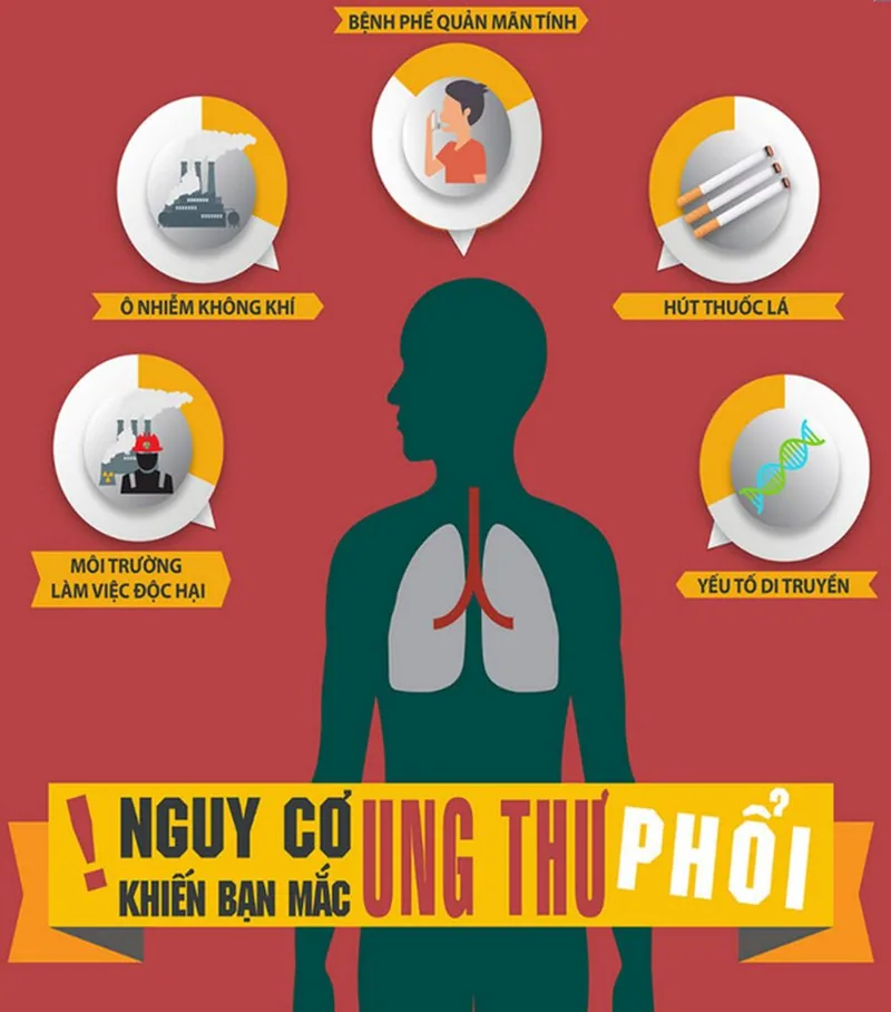 Bệnh viện Sante - Nguyên nhân ung thư phổi_ yếu tố ảnh hưởng_ cách phòng ngừa