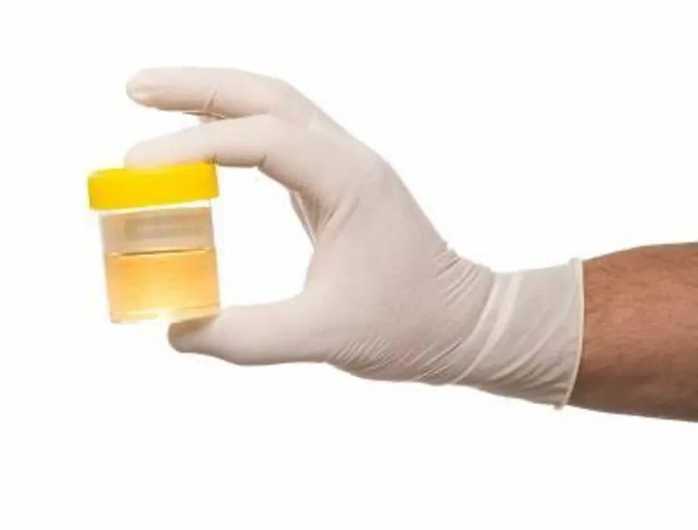 Bệnh viện Sante - Nhiễm trùng tiểu trẻ em (Hình 2) Bệnh viện Sante - Nhiễm trùng tiểu trẻ em (Hình 2)
