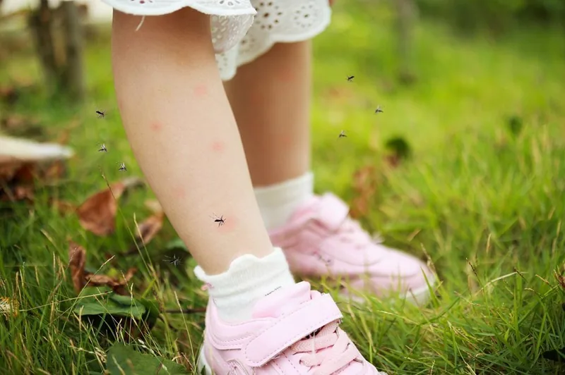 Bệnh viện Sante - Bệnh sốt xuất huyết