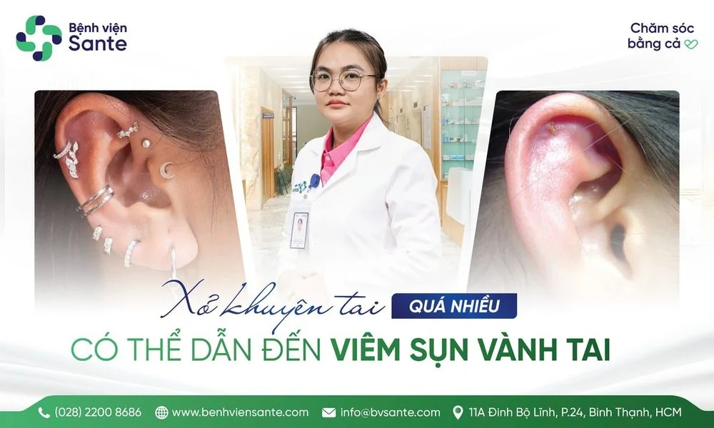 XỎ KHUYÊN TAI QUÁ NHIỀU DẪN ĐẾN VIÊM SỤN VÀNH TAI - Bệnh viện SANTE Bình Thạnh, TP.HCM XỎ KHUYÊN TAI QUÁ NHIỀU DẪN ĐẾN VIÊM SỤN VÀNH TAI - Bệnh viện SANTE Bình Thạnh, TP.HCM