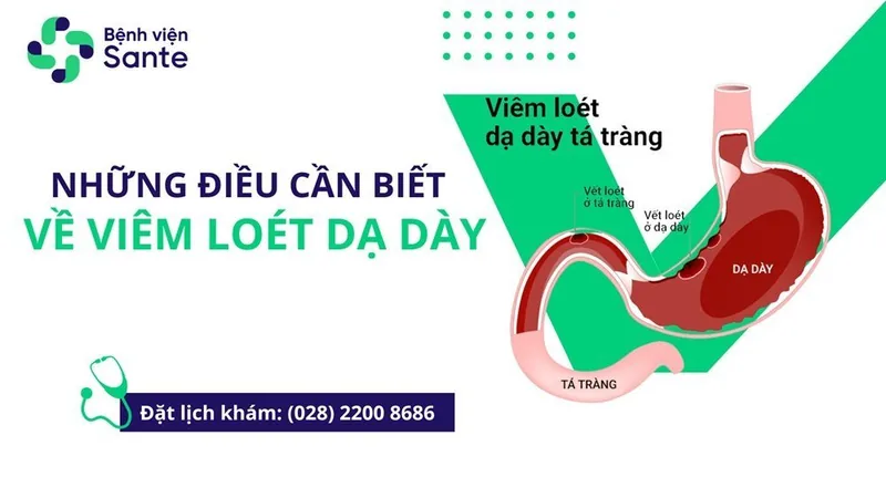 Những điều cần biết về viêm loét dạ dày