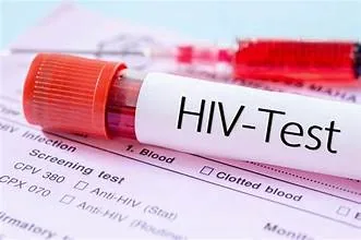 NGÀY THẾ GIỚI PHÒNG TRÁNH AIDS - Hình 2 - Bệnh viện SANTE Bình Thạnh, TP.HCM NGÀY THẾ GIỚI PHÒNG TRÁNH AIDS - Hình 2 - Bệnh viện SANTE Bình Thạnh, TP.HCM
