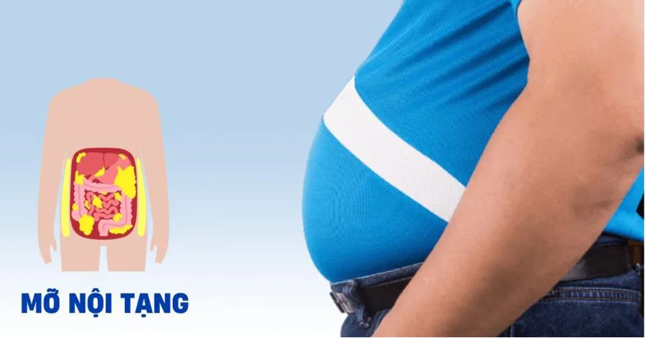 NGUYÊN NHÂN GÂY MỠ NỘI TẠNG - Hình 2 - Bệnh viện SANTE Bình Thạnh, TP.HCM