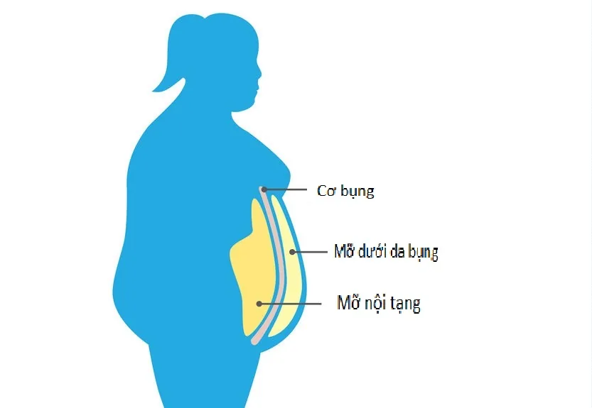 NGUYÊN NHÂN GÂY MỠ NỘI TẠNG - Hình 3 - Bệnh viện SANTE Bình Thạnh, TP.HCM
