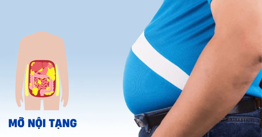 NGUYÊN NHÂN GÂY MỠ NỘI TẠNG - Hình 2 - Bệnh viện SANTE Bình Thạnh, TP.HCM
